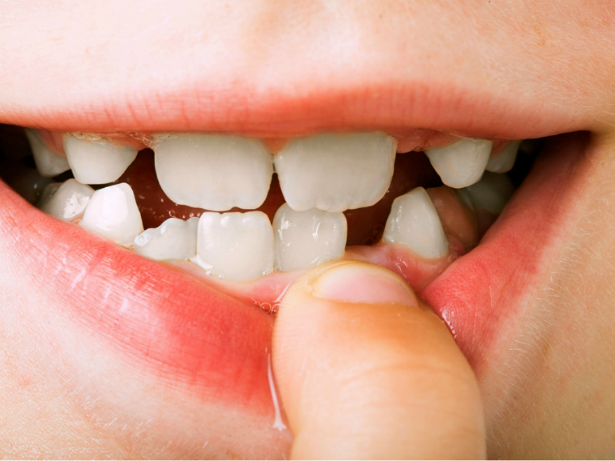 7 Tips for Parents to Help Improve Kids Oral Health Habits
